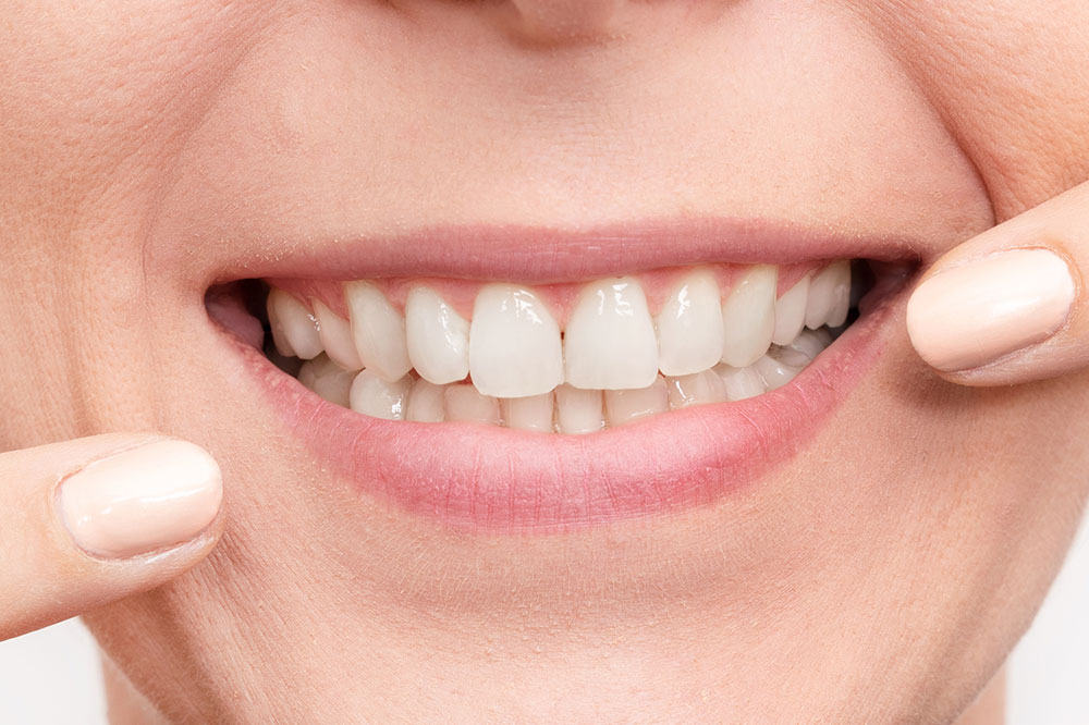 Best Ways to Whiten Teeth at Home