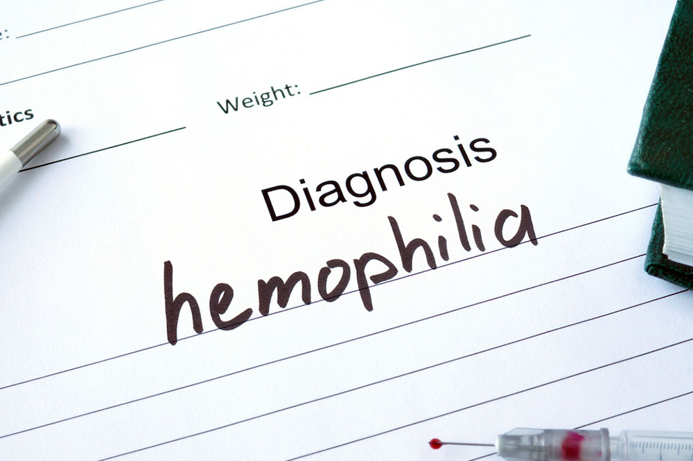 5 Popular Treatment Procedures for Hemophilia